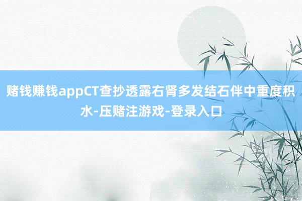 赌钱赚钱appCT查抄透露右肾多发结石伴中重度积水-压赌注游戏-登录入口